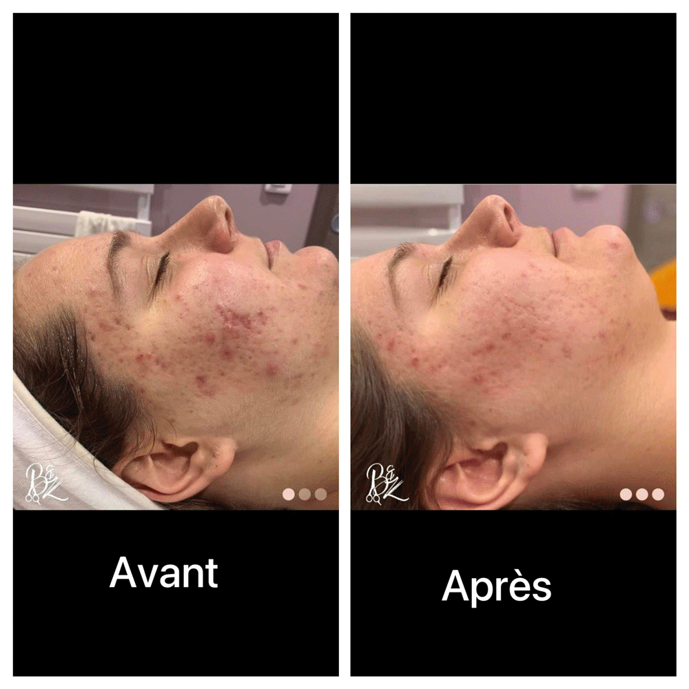 Avant-Apres_Advance_Beauty_Anti-ageing_animation_GIF